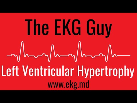left-ventricular-hypertrophy-on-ekg-/-ecg-l-the-ekg-guy---www.ekg.md