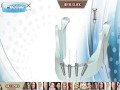 Cortex dental implants clever click connection