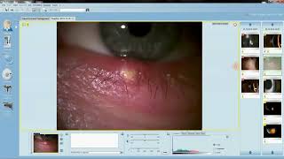 Eyesuite Slit Lamp Intermediate Help Guides Image Viewer Screen Elements