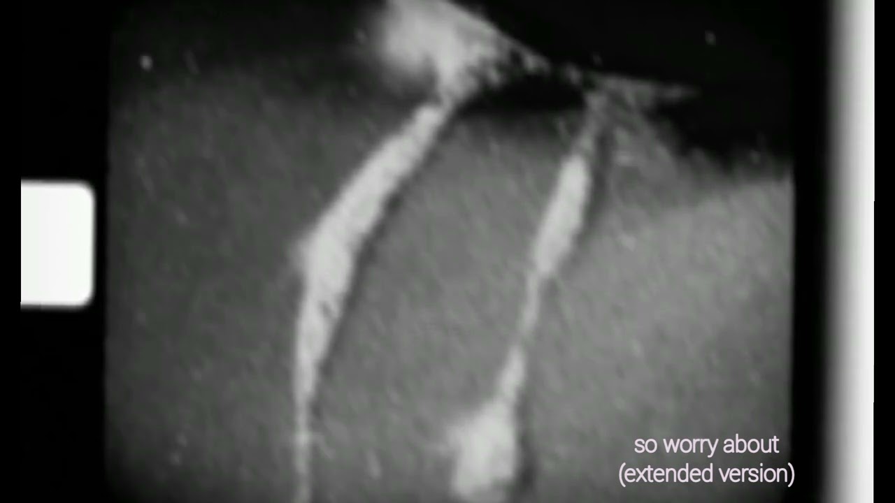 Molech Dawid - so worry about (v.ll - extended version) [official audio]