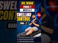 ACL REHAB | PHASE-1 | WEEK 0-2 | GOAL-1| SWELLING CONTROL 🔥 #ACLRehab #KneeRehab #SportsPhysio