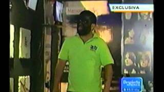 Hypertrichosis With Dr. Janelle Vega Mayoral.wmv