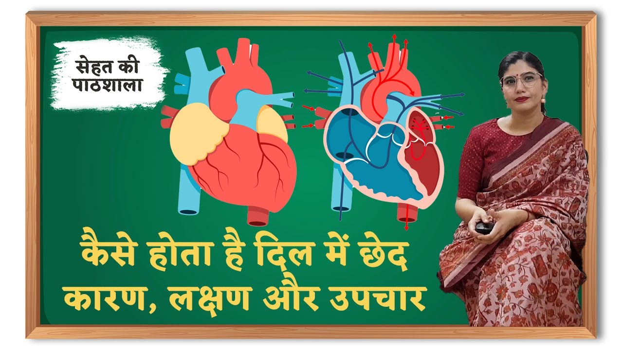 दिल में छेद/सुराख : कारण, लक्षण, इलाज । Hole in Heart: Causes, Diagnosis, Treatment- Doctor Explains