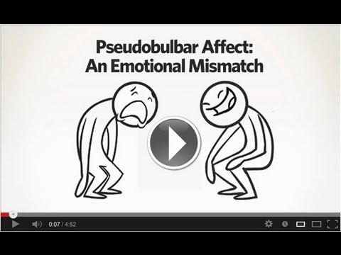 Video: Pseudobulbar Affect E SM: Cause, Informazioni Per Il Paziente