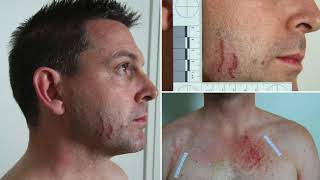 Gerard Baden-Clay case