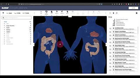 EUI 1.7.0 Demo