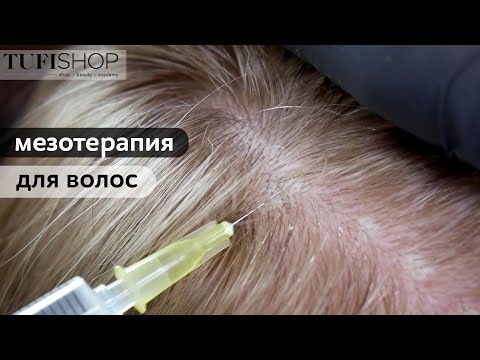 Мезотерапия для волос| Лечение | Против выпадения| Для роста| Советы врача- косметолога