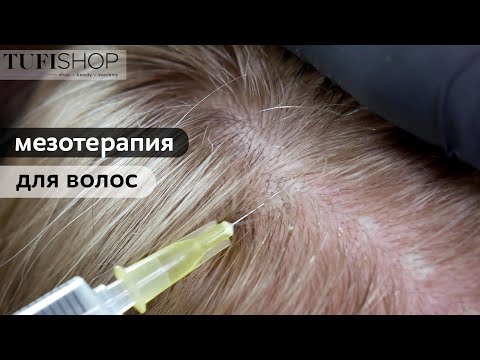 Мезотерапия для волос в домашних условиях какие препараты