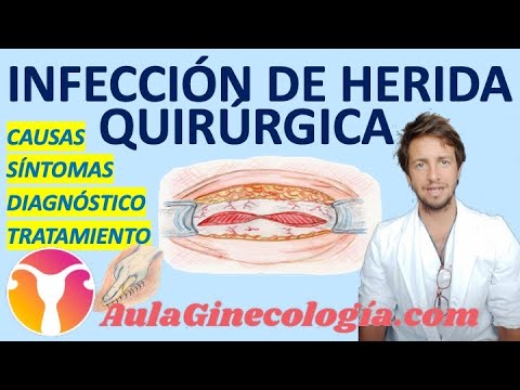 INFECCIÓN DE HERIDA QURÚRGICA: PROFILAXIS, DIAGNÓSTICO, TRATAMIENTO... - Ginecología y Obstetricia -