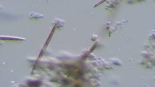 Fragilaria, etc 240606 2059