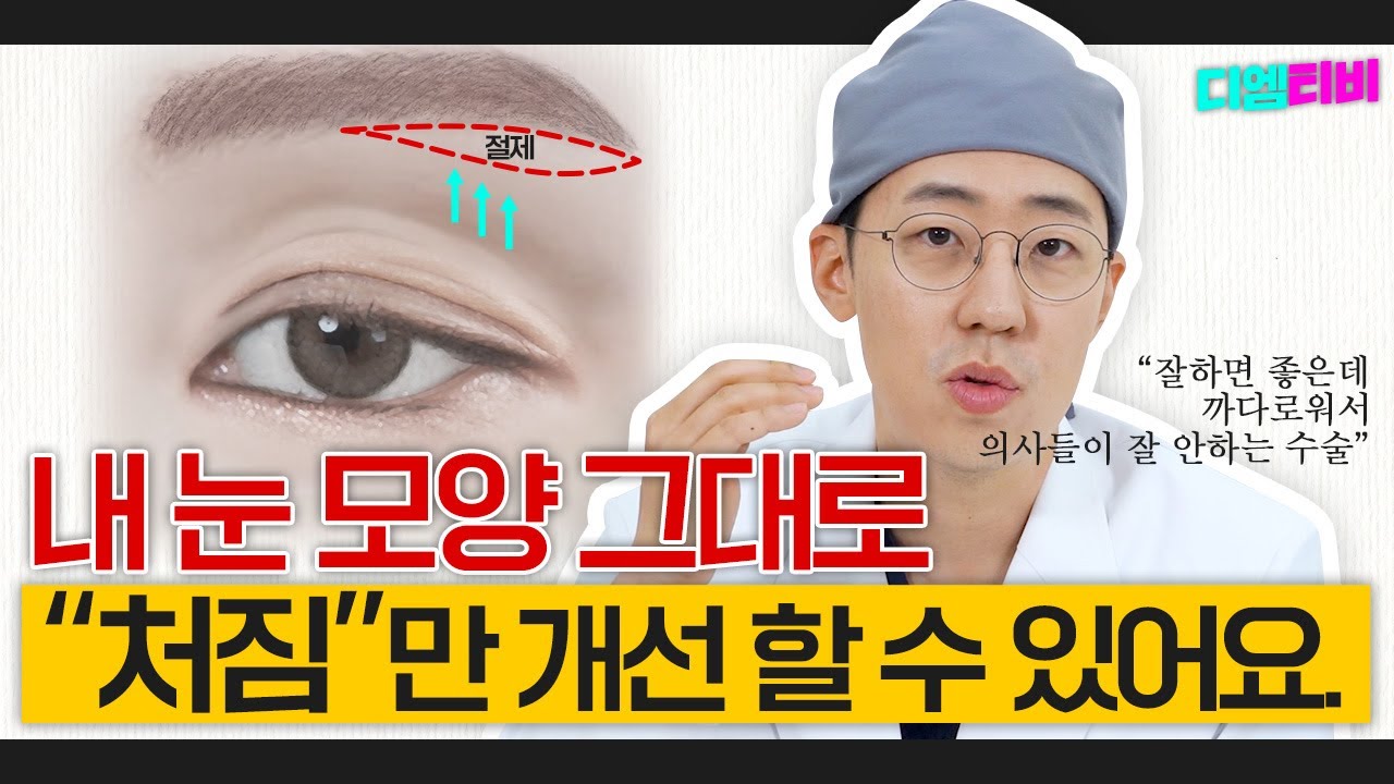 눈썹하거상이라고 아세요? #눈썹하거상술 #중년눈성형 #눈성형