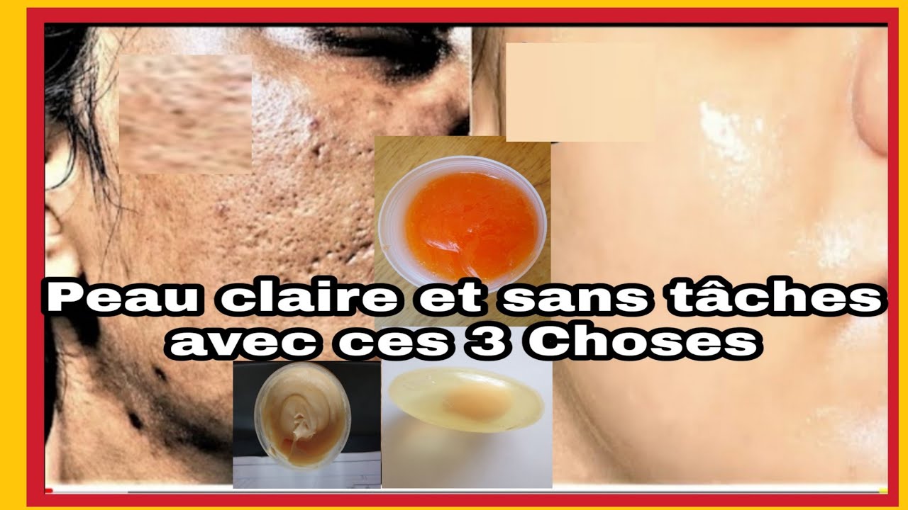 Peau Claire et Sans Tâches avec cette Routine des Éléments:Savon