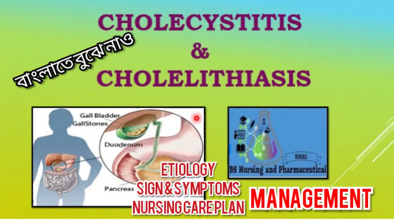 Cholecystitis Cholelithiasis Medical Surgical Nursing Cholecystitis Cholelithiasis Medical Surgical Nursing