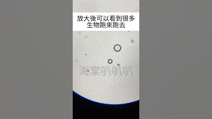 你愛吃小龍蝦嗎？放大200倍後中國野生小龍蝦你還敢吃嗎？