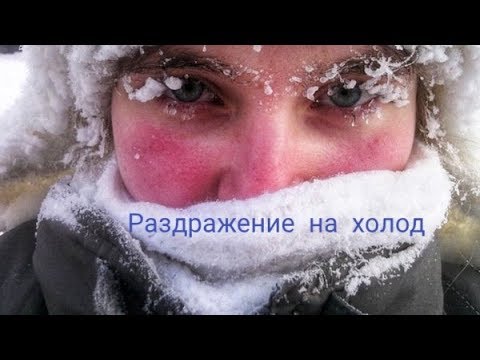 Обветренная кожа. Раздражение кожи на холод. Аллергия на мороз.