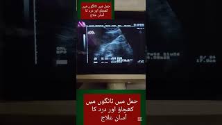 Legs Pain&amp; Legs Cramps In Pregnancy Treatment| legs cramps Relief Exercise #ytshorts