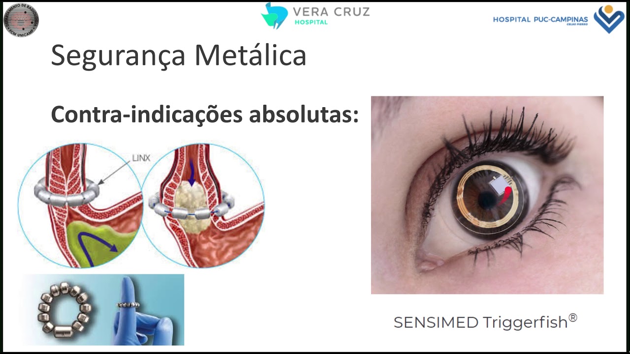 Conceitos básicos de segurança metálica em ressonância magnética.