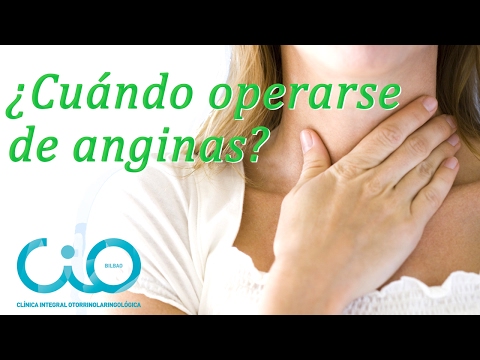 Vídeo: Angina Lacunar En Adultos: Causas, Síntomas Y Tratamiento