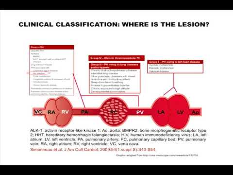 Pulmonary Hypertension in HIV