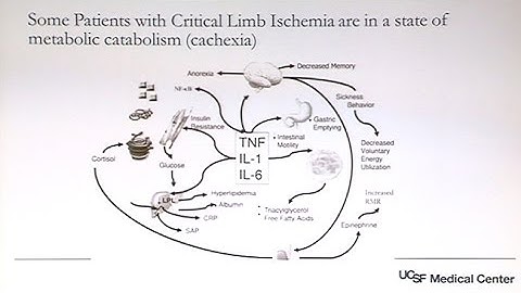The Fate of the CLI Patient