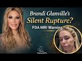 Brandi's Face, Breast Implants And The FDA