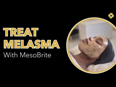 glutathione patches durban Treat Melasma with MesoBrite™ ympäristöystävällinen