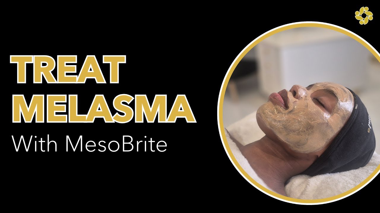 Treat Melasma with MesoBrite™