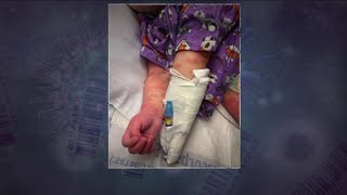 Expect more cases of strange coronavirus syndrome in kids, doctors warn