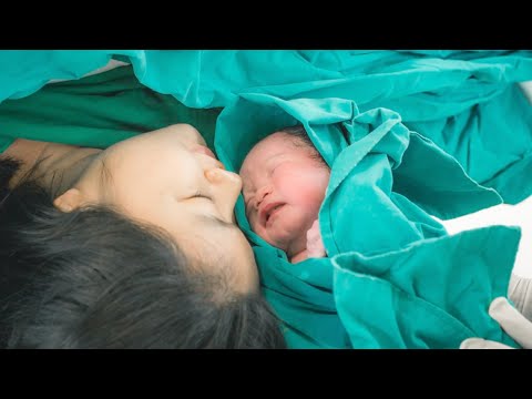 ولادة بدون الم