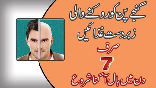 Ganjpan Ka Asan Ilaajjald Baal Ajaingbaldness Treatment.