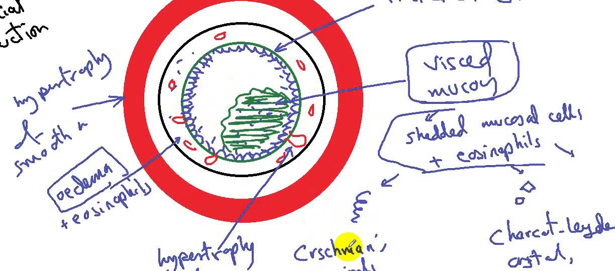 systemic pathology  respiratory system bronchial asthma DR SAMEH GHAZY