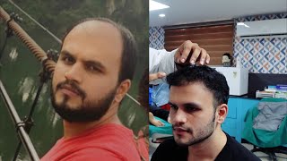 Hair O Dent in KadavantharaErnakulam  Best Hair Transplant Clinics in  Ernakulam  Justdial