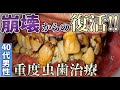 崩壊からの‥復活‼️🤩【40代重度虫歯治療🦷】Resurrection from the collapse! ️ [Severe dental caries treatment in 40s ]