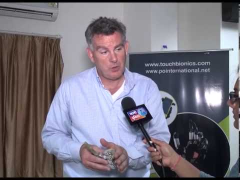 i-limb ultra: prosthetic hand Touch Bionics, Ahmedabad - JanoDuniya