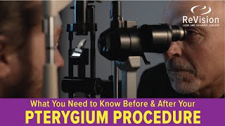 Preparing for Your Pterygium Procedure