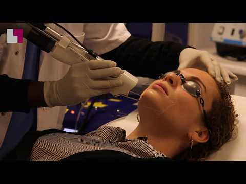 Conseils pour l’épilation laser du visage