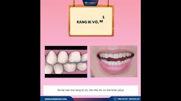 Những trường hợp nào nên trám răng? #stdentist #nhakhoauytin #nhakhoaquan10 #teeth