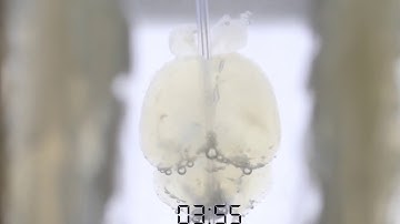 Time-lapse of a mouse brain being cleared with the X CLARITY™ Tissue Clearing System