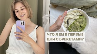 ЧТО Я ЕМ В ПЕРВЫЕ ДНИ С БРЕКЕТАМИ?