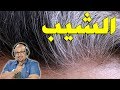 الوصفة القاضية على الشيب لجميع انواع الشعر من الدكتور عماد ميزاب imad Mizab
