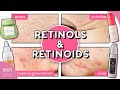 How to Use RETINOL for Acne, Hyperpigmentation, Large Pores, Fine Lines & More!