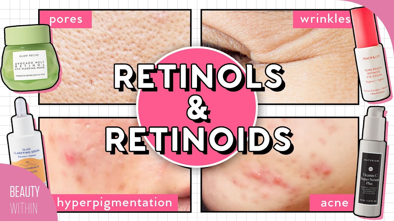 ønskelig sød underholdning How to Use RETINOL for Acne, Hyperpigmentation, Large Pores, Fine Lines &  More! - YouTube