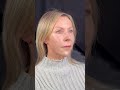 Didn’t Realize Jawline Filler Could Change This Much