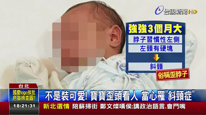 不是裝可愛!寶寶歪頭看人當心罹斜頸症 - 天天要聞