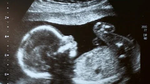 When can I find out my baby's gender? - DayDayNews