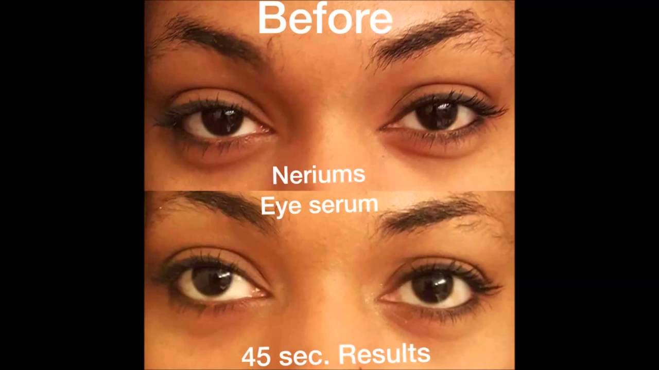 Nerium Eye Serum KAL Productions
