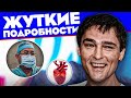 Врач рассказал, как можно было спасти Юру Шатунова!