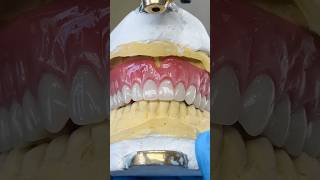 Fitting a Denture Try-In #lsk121shorts #dentist