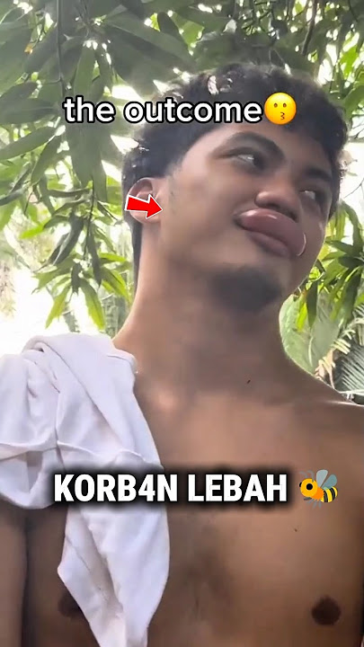 Pria ini Awalnya Senang Jadi Meri4ng #funny #ngakak #shorts