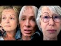 УЖАС! Как ЗНАМЕНИТОСТИ выглядят без МАКИЯЖА и ФОТОШОПА — шокирующие кадры!